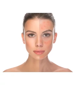 Kad se tvoja koža pobuni: korejska reset rutina koja ponovno djeluje