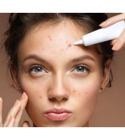 Akne i čarolija K-beauty