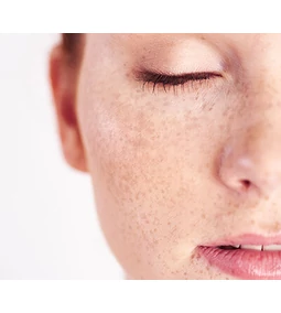 Niacinamid vs. Arbutin: Koji je najučinkovitiji protiv pigmentnih mrlja?