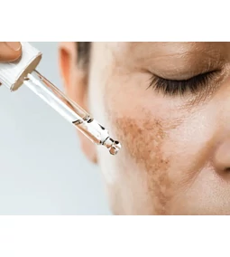 Pigmentne mrlje kroz K-beauty prizmu – korejske tajne blistave kože