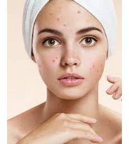 Nega kože najstnikov po K-beauty načinu: najboljši začetni izdelki