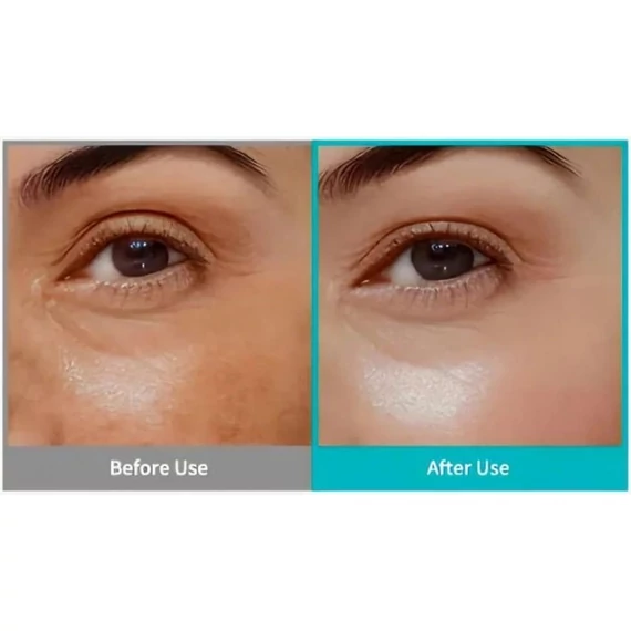Rejuran Intensive Eye Cream – Anti-Aging Szemkörnyék Krém 20ml