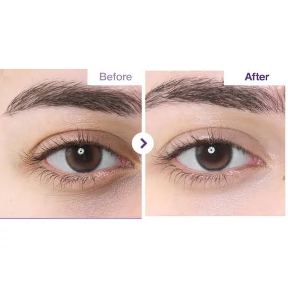 Numbuzin No.9 NAD+ Retinal Volumetox Eye Cream – Krema za Oči za Povećanje Volumena 20ml