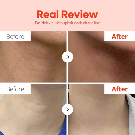 Dr. Melaxin Necklinephalt Neck Cream – Nyakkrém Ráncok Ellen 20ml