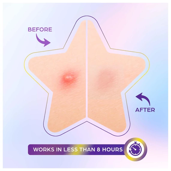 OOTD BEAUTY OOTD Star Spot Patch – Náplasti Na Akné 80ks