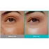 Kép 4/4 - Rejuran Intensive Eye Cream – Anti-Aging Szemkörnyék Krém 20ml